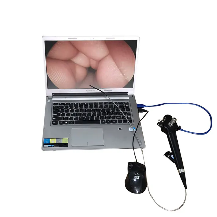 

MY-P006-G medical supply endoscope usb flexible electronic gastroscope colonoscope portable