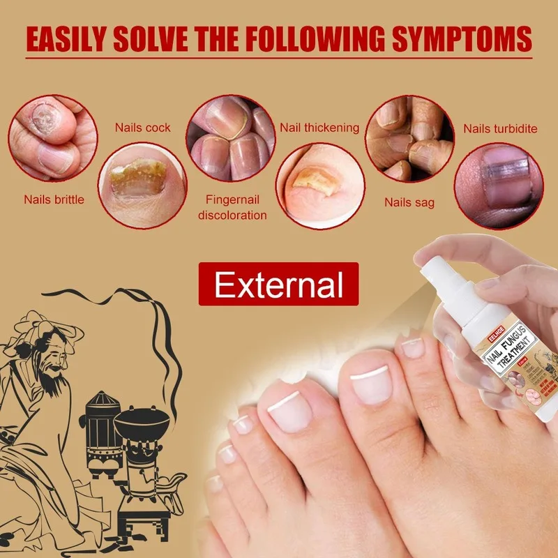 Фото 30ml Nail Fungal Treatment Spray Feet Repair Serum Nails Foot Toe Fungus Removal Gel Anti Infection Paronychia Onychomycosis №3