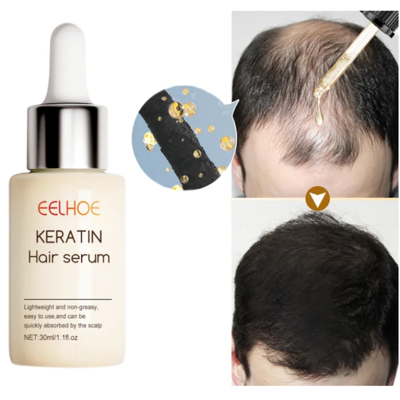 Hair Growth Serum Anti-Baldness Preventing Hair Loss Essence Hair Regrowth Spray Hair Thinning Treatment Liquid Beauty Health