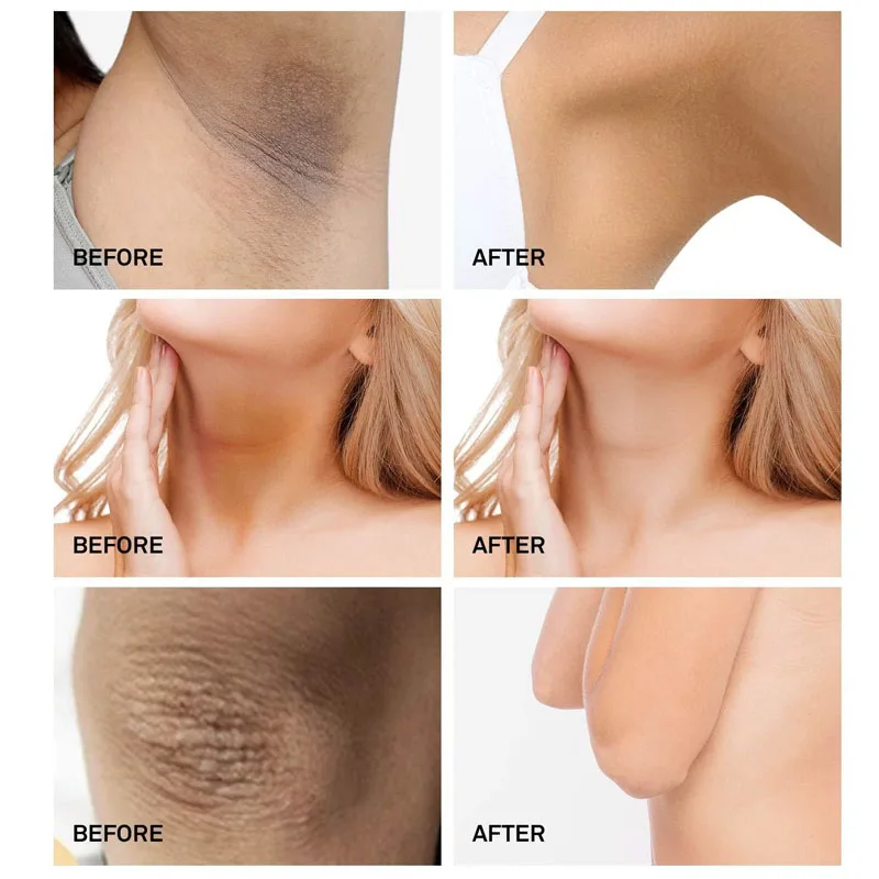 Рисунок 3 - Отбеливающий крем для тела