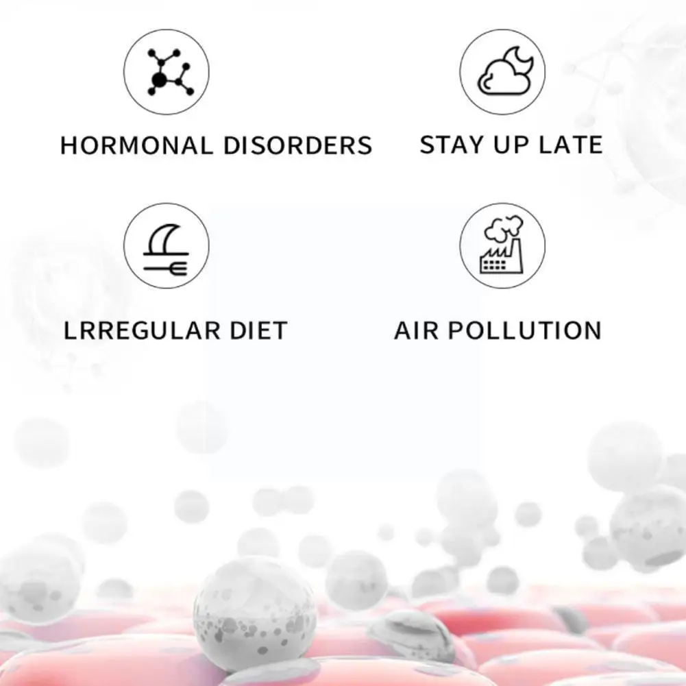 

Очищение акне крем для удаления акне, акне, крем для быстрого удаления акне, крем против акне, очищающее лечение акне, V4d1