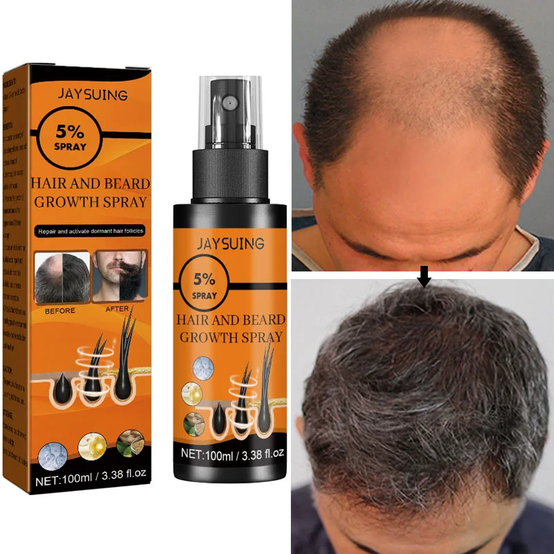 

Fast Hair Growth Spray Product Anti Hair Loss Serum Scalp Treatment Prevent Baldness Thinning Dry Frizzy Repair Beauty Hair Care