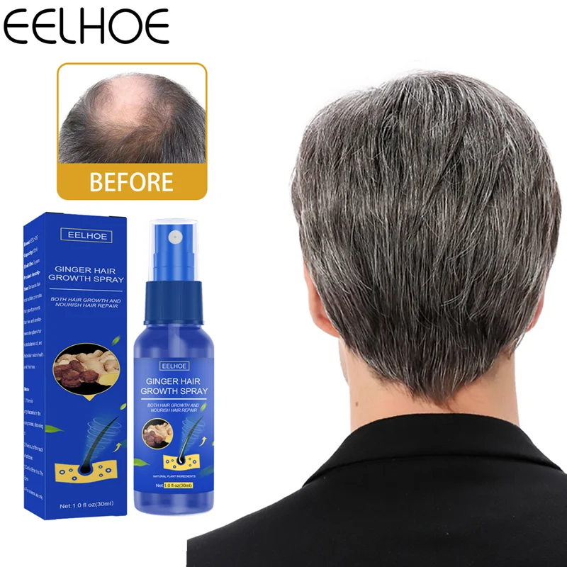 

EELHOE имбирный спрей для роста волос Массажер для кожи головы увлажняющий плотный Уход за волосами питательный спрей