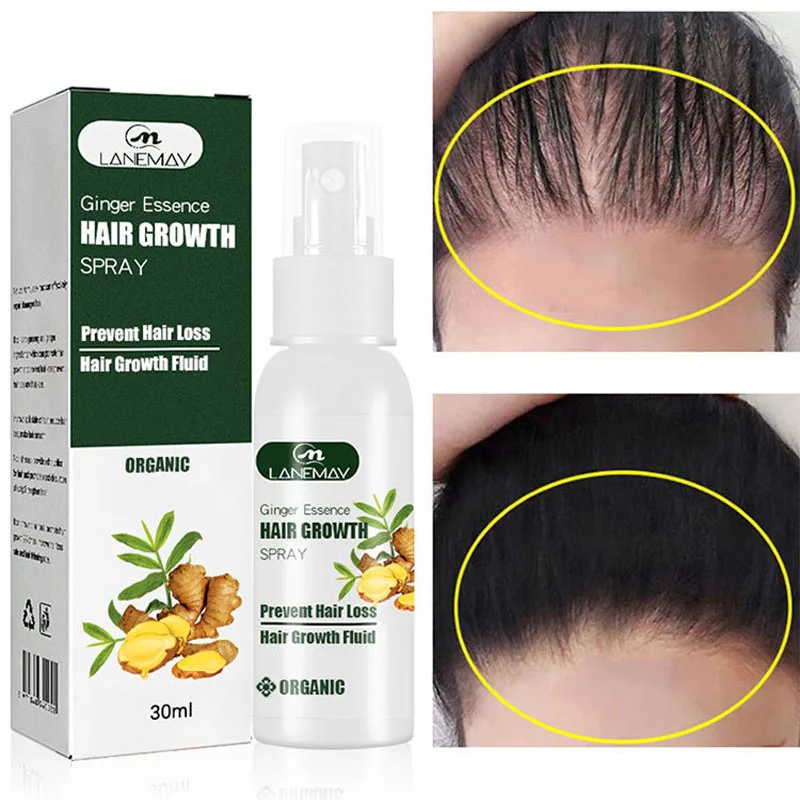 Ginger Hair Growth Spray Fast Growing Prevent Hair Loss Products Repair Frizzy Dry Damaged Hair Nourishing Essence For Men Women