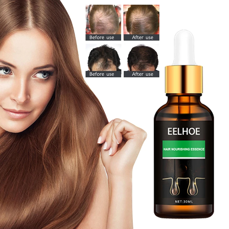 

Ginger Hair Growth Essences For Hair Germinal Hair Growth Serum Essences Oil Hair Loss Treatment Growth Olive Oil For Hair TSLM2