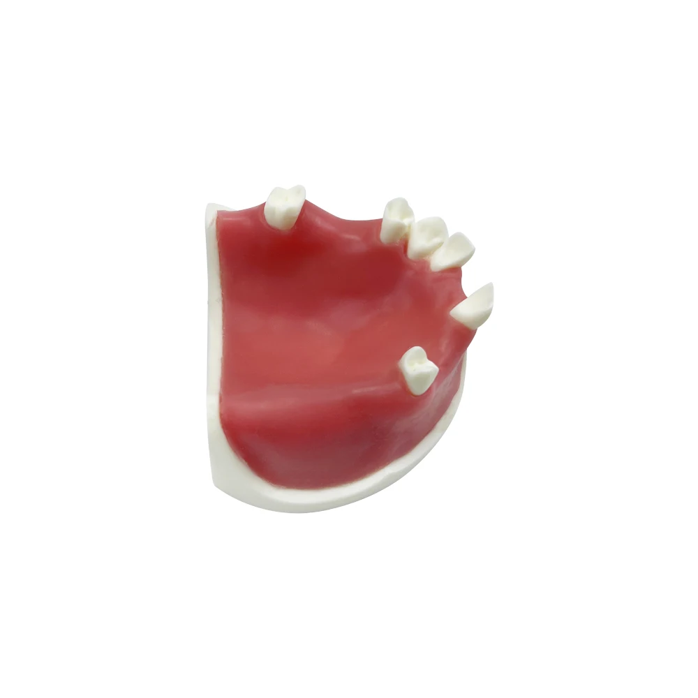 Модель зубного имплантата реставрация зубов обучающая учебная модель Typodont с