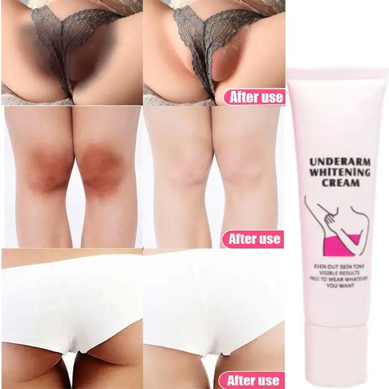 

Whitening Cream Private Parts Whitening Cream Arm Thigh Body Knees Whitening Brighten Skin Mild Non-irritating