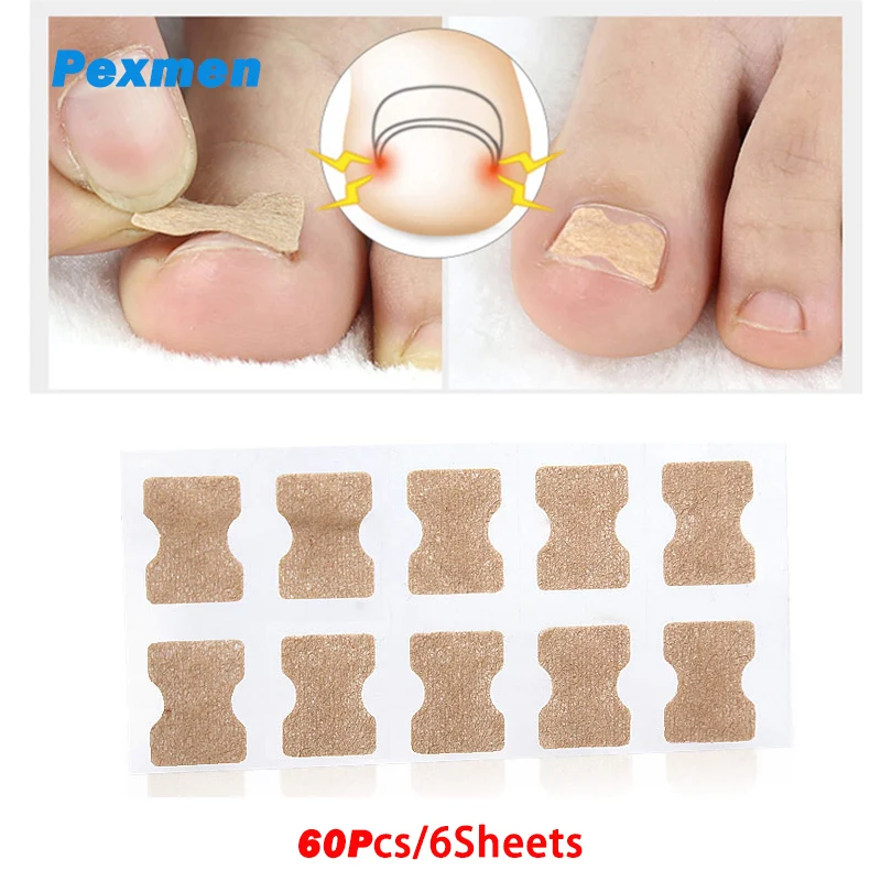 

Pexmen 60Pcs/6Sheets Ingrown Toenail Correction Sticker Ingrown Toenail Corrector Foot Care Pedicure Tool Toe nail Pads