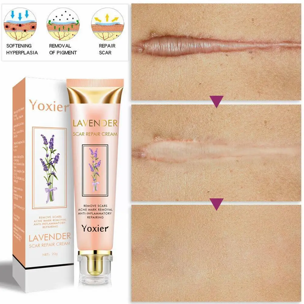 

Yoxier Lavender Scar Repair Cream Acne Scar Removal Corrector Smooth Marks Stretch Scar Remove Pigmentation Whitening Skin P1v6