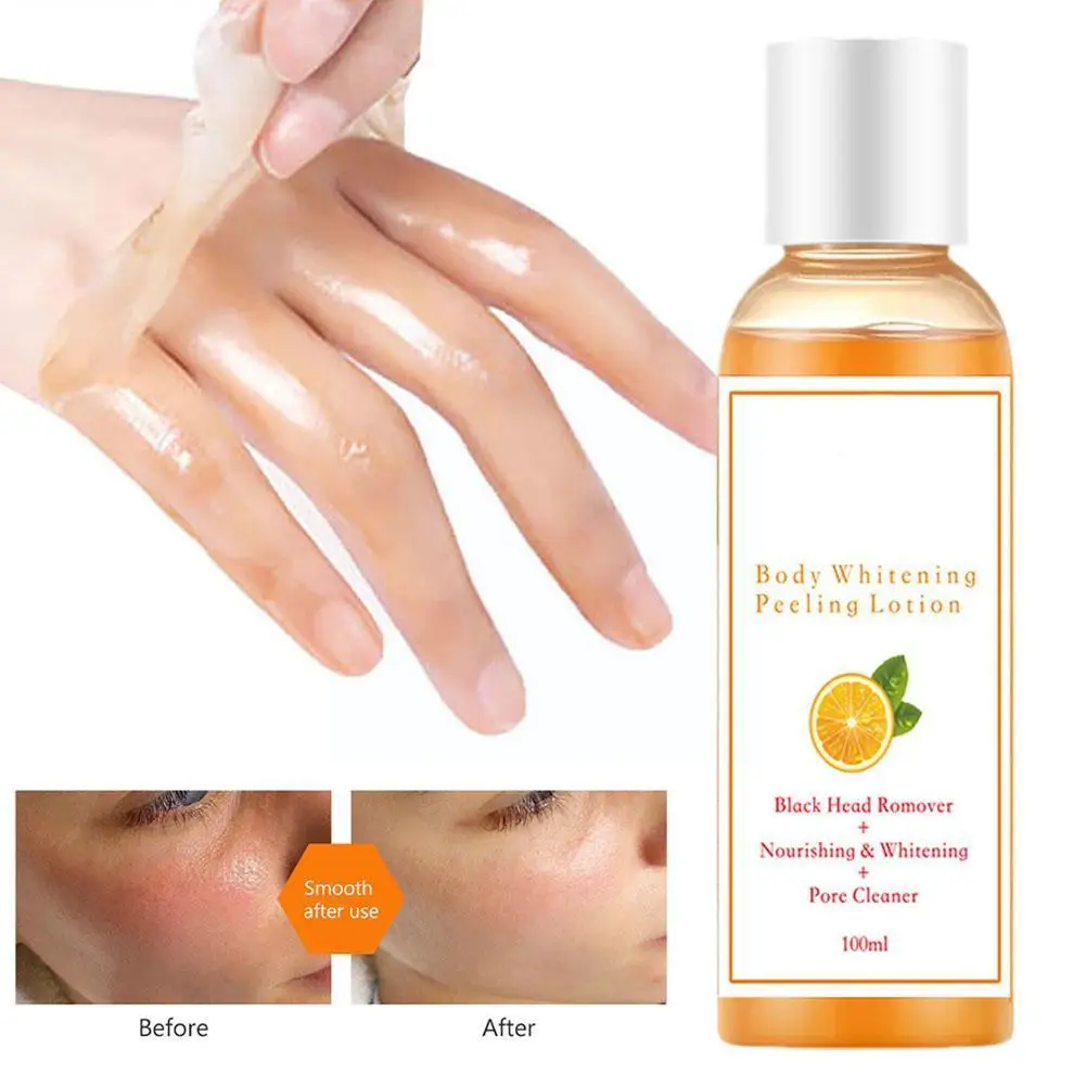 

100ml Peeling Oil Vitamin C Orange Body Face Lotion Whitening Dead Peeling Intense Knuckles Anti Dark Skin Remove L8Q0