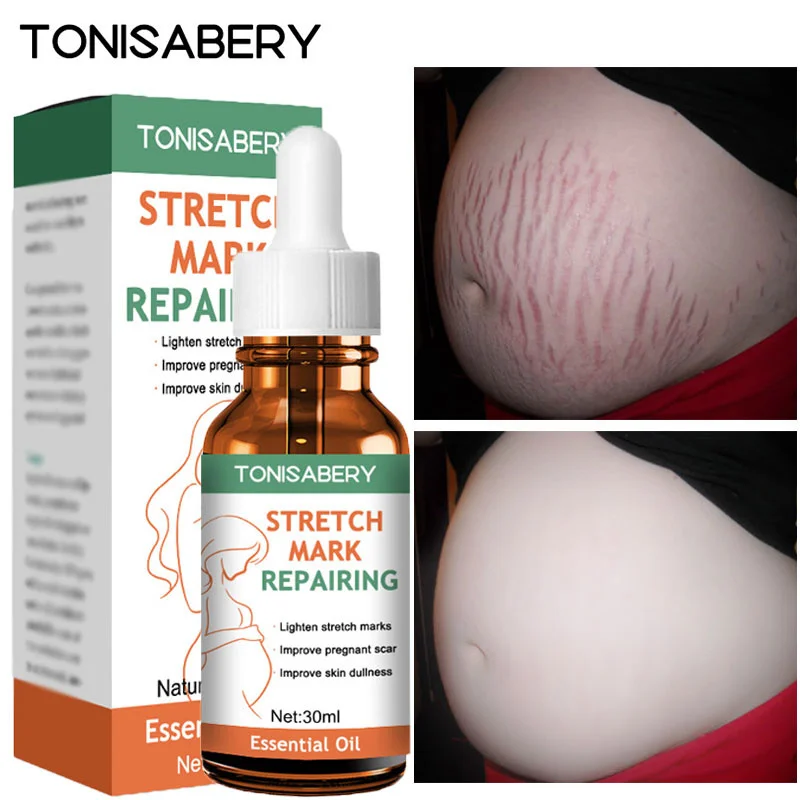 

Stretch Mark Removal Essential Oil Treatment Pregnant Women Stretch Mark Tightening Loose Line Anti-aging Moisturizing Body Care
