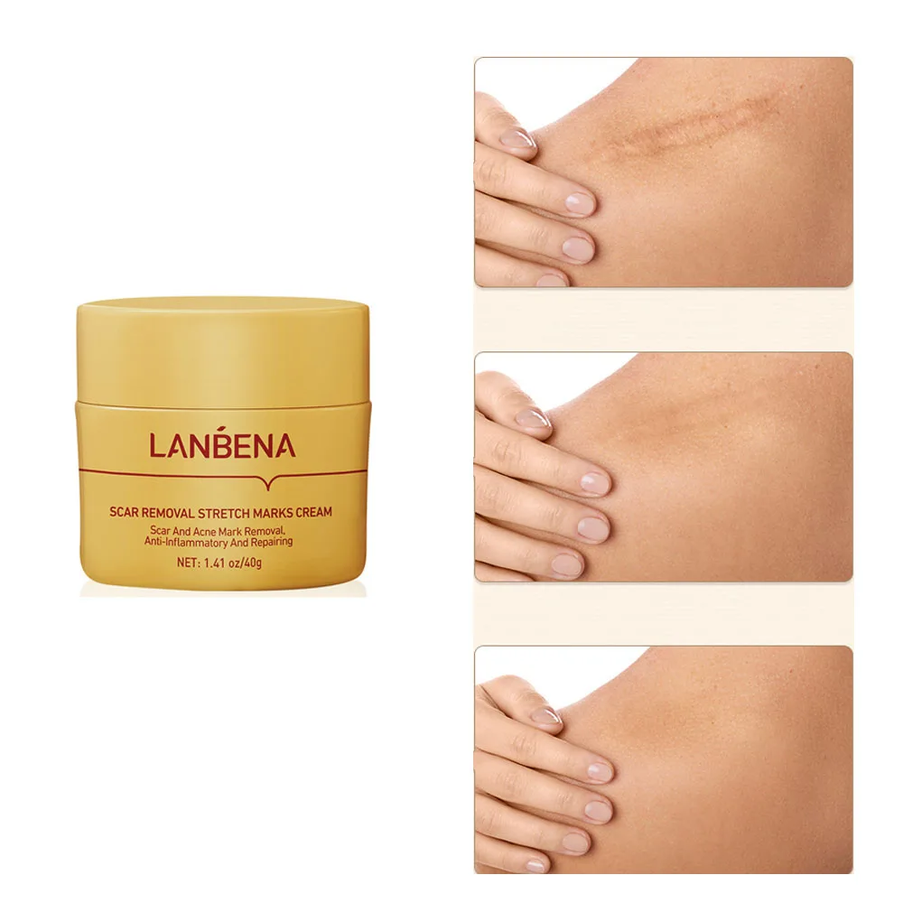 LANBENA New Scar Removal Cream Acne Treatment Repairing Scar Non Irritating Whitening Cream Anti Winkles Moisturizing Skin Care