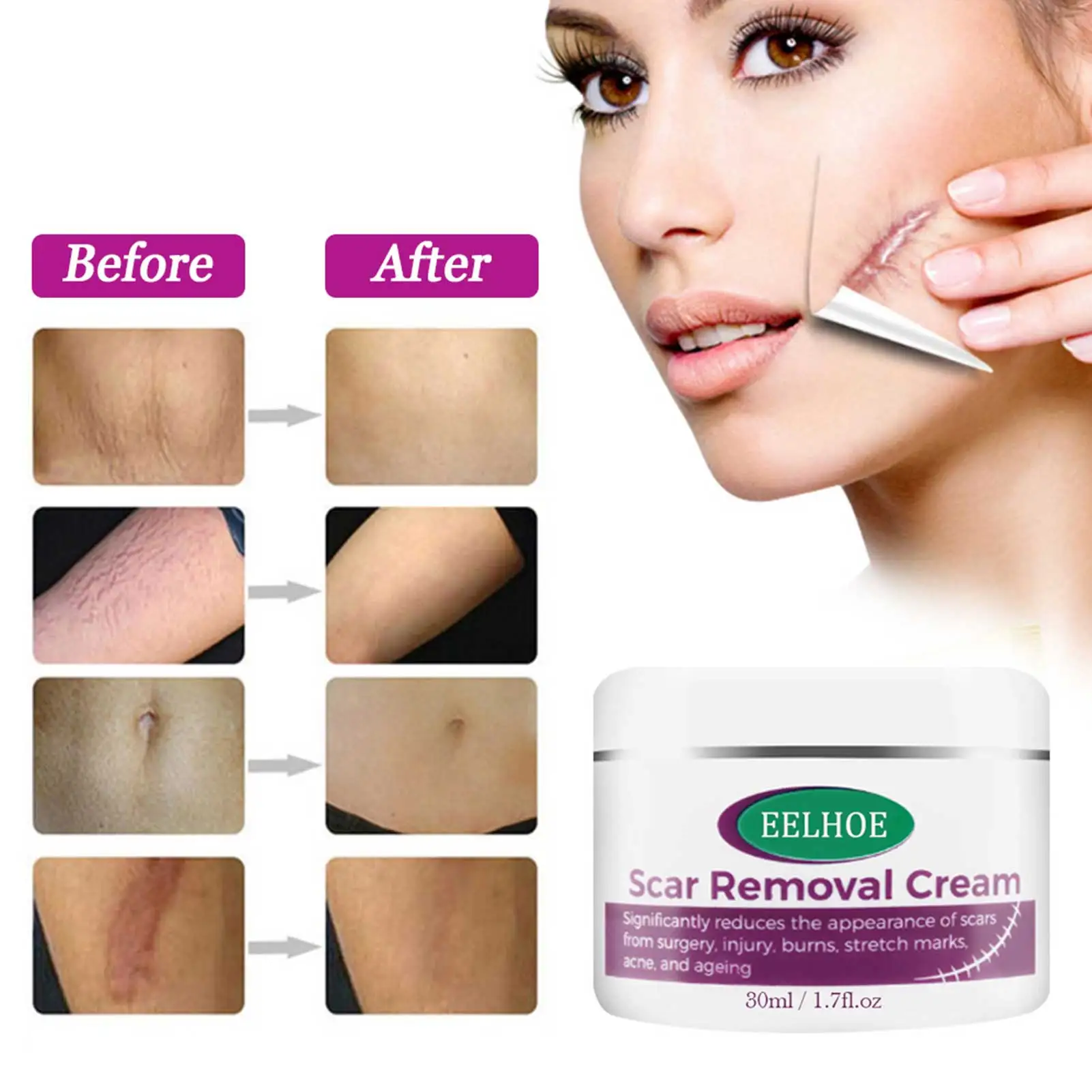 

50ML Effectivel Scar Removal Cream Advanced Treatment Face And Body Scars Cuts Stretch Marks Scar Gel Ointment Skin Care
