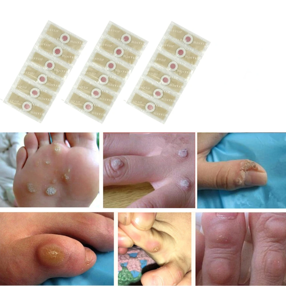 

24PCS Medical Corn Plaster Foot Corn Removal Warts Thorn Detox Adhesive Patches Feet Care Calluses Callosity Clavus Remove Tool