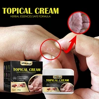 blister hand and foot antipruritic cream skin dry itching mosquito bite antipruritic cream repair cream skin antipruritic cream
