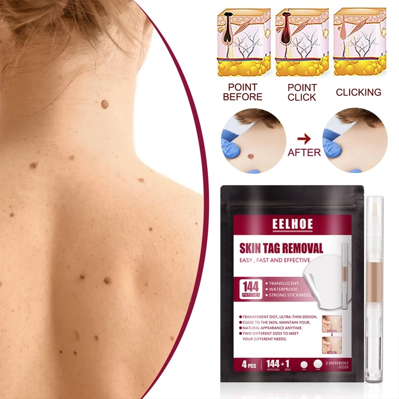 

Wart Sticker Pen Set Acne Remove Skin Tag Body Wart Treatment Sticker Invisible Acne Patch Pimple Remover Skin Care Tool