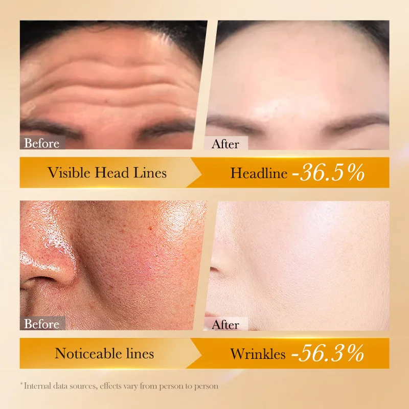 Набор пептидов для ухода за кожей ретинола средство против морщин старения