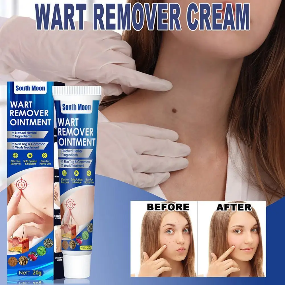 

Warts Remover Cream Skin Tag Remover Against Mole Antibacterial Ointment Wart Treatment Herbal Extract Corn Plaster