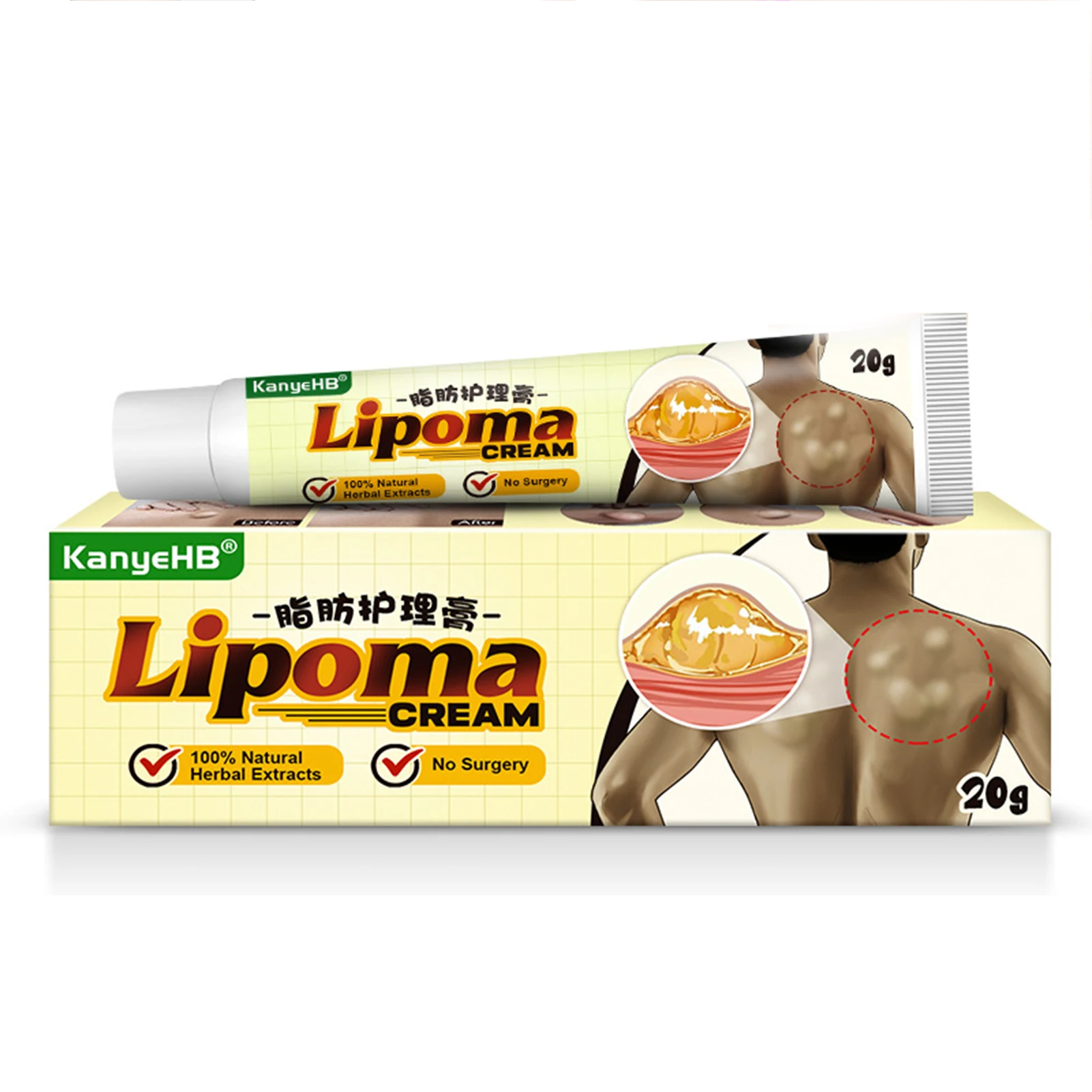 

Крем от отеков Lipoma, эффективная мазь по уходу за лимфатией для облегчения гипертрофии шеи