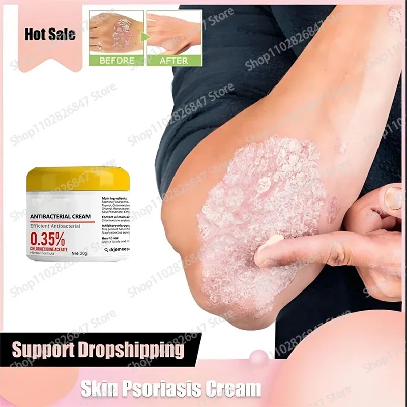 Антибактериальная мазь для лечения псориаза тела и бедра
