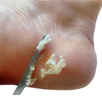 manicure pedicure tools toe nail shaver feet pedicure knife kit foot callus rasp file dead skin remover foot care tools