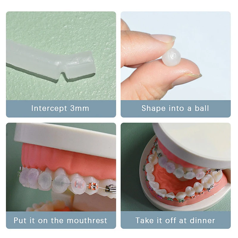 5 шт./коробка Ортодонтические средства для отбеливания зубов