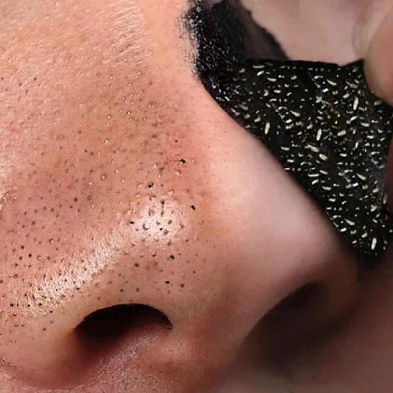 

NEW 10PC Tear Type Mask Nose Paste Blackhead Acne Removal Pore Black Head Cleaner Strong Sticker Comedone Extractor
