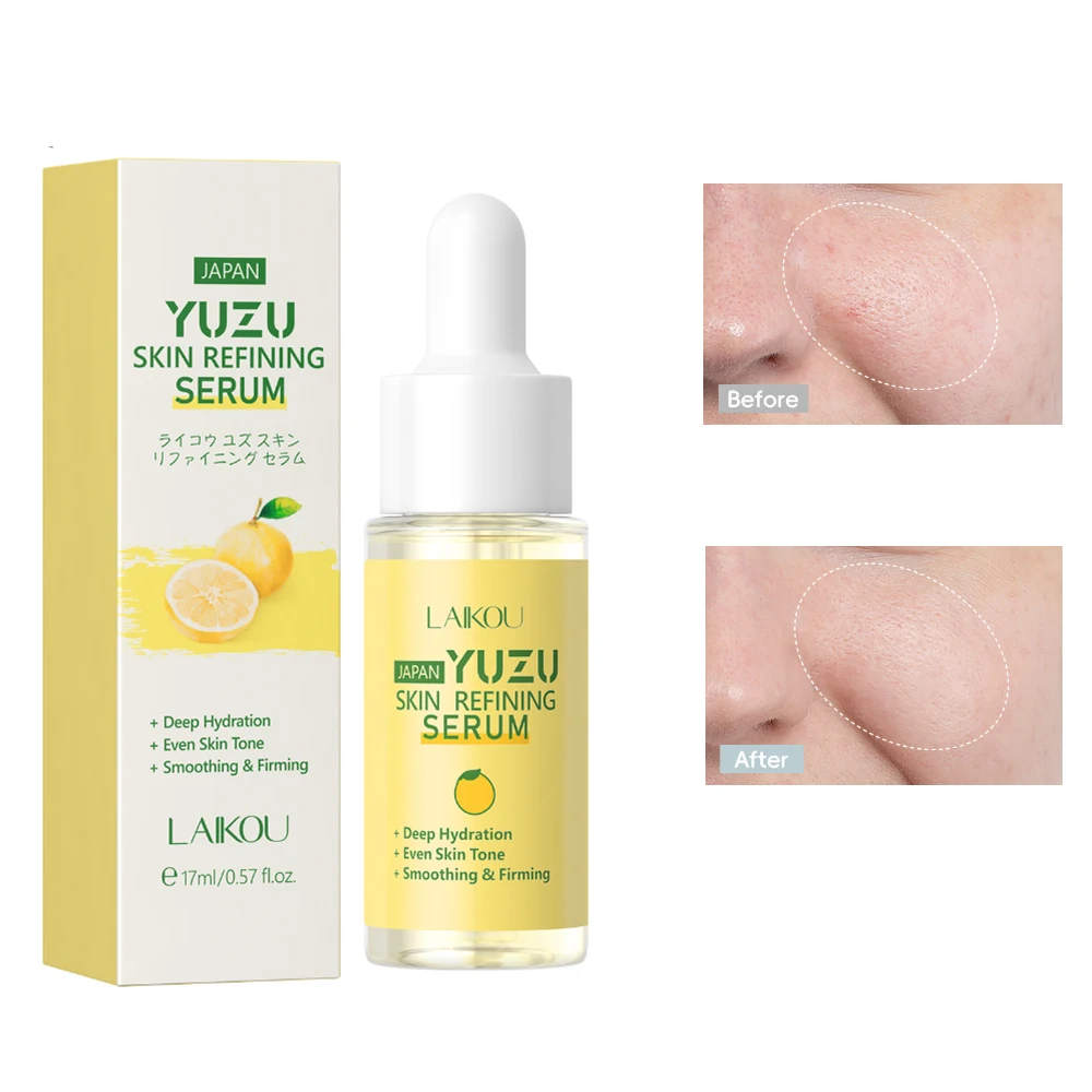 Сыворотка Yuzu Faciale Originales Melasma для удаления темных пятен увлажняющий крем подтяжки