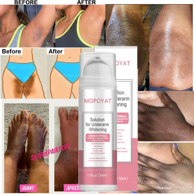 

Powerful Effective Black Joint Makeup Remover Serum Powerful Whitening Cream Hand Joint Eraser Serum for Elbow Knees Dark Skin