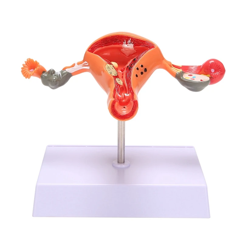 

Uterus Model Ovary Model Anatomy Female Reproductive Organ Model Shows Uterus Ovary Vagina Uterine Teaching
