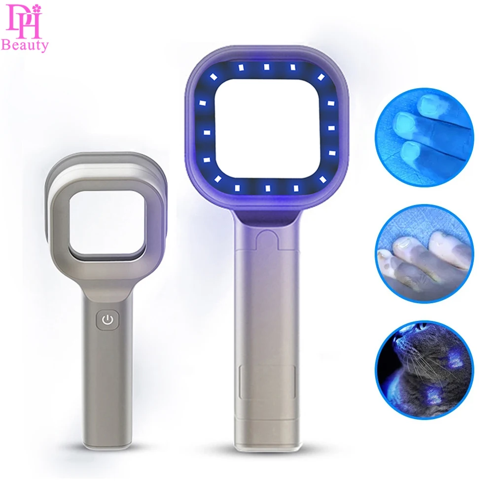 

Wood's Lamp For Skin Examination Test Medical Diagnostic Analyzer Machine Ultraviolet Facial Skin Analysis Personal Beauty Care