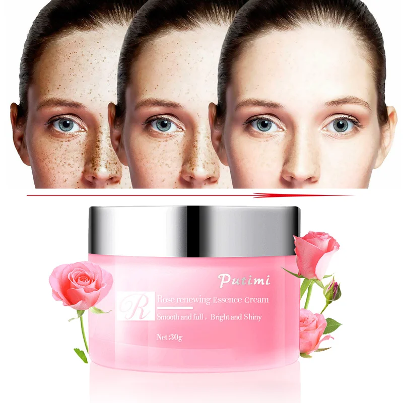 

Whitening Freckles Cream Remove Dark Spots Freckle Serum Fade Acne Scars Melanin Pigmentation Melasma Anti-Aging Brighten Skin