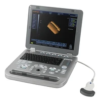 ce best price clinic hospital use china portable ultrasound machine for sale 3d color display ultrasound sun 800d