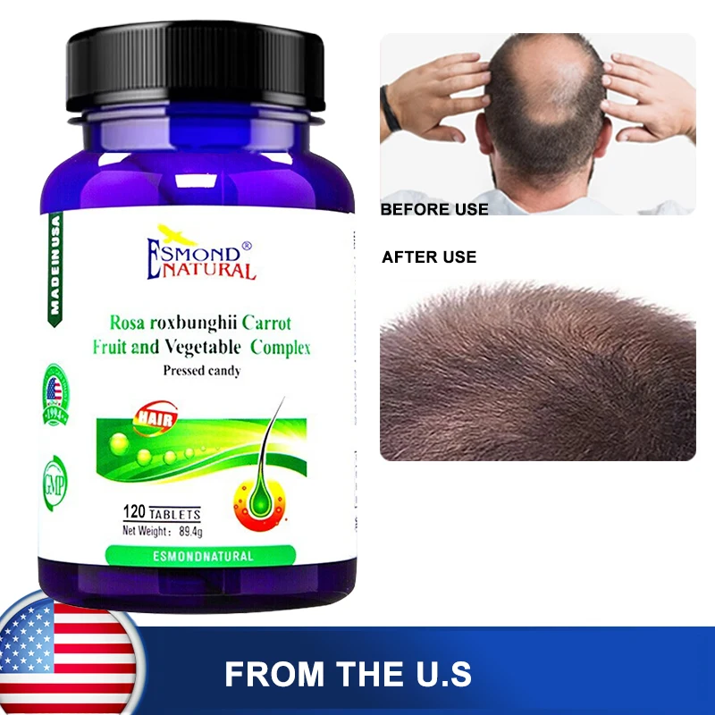 Hair Growth Nutritional Supplements Prevent Hair Loss Dredge Hair Follicles Fast Hair Growth Inhibit Oil Secretion