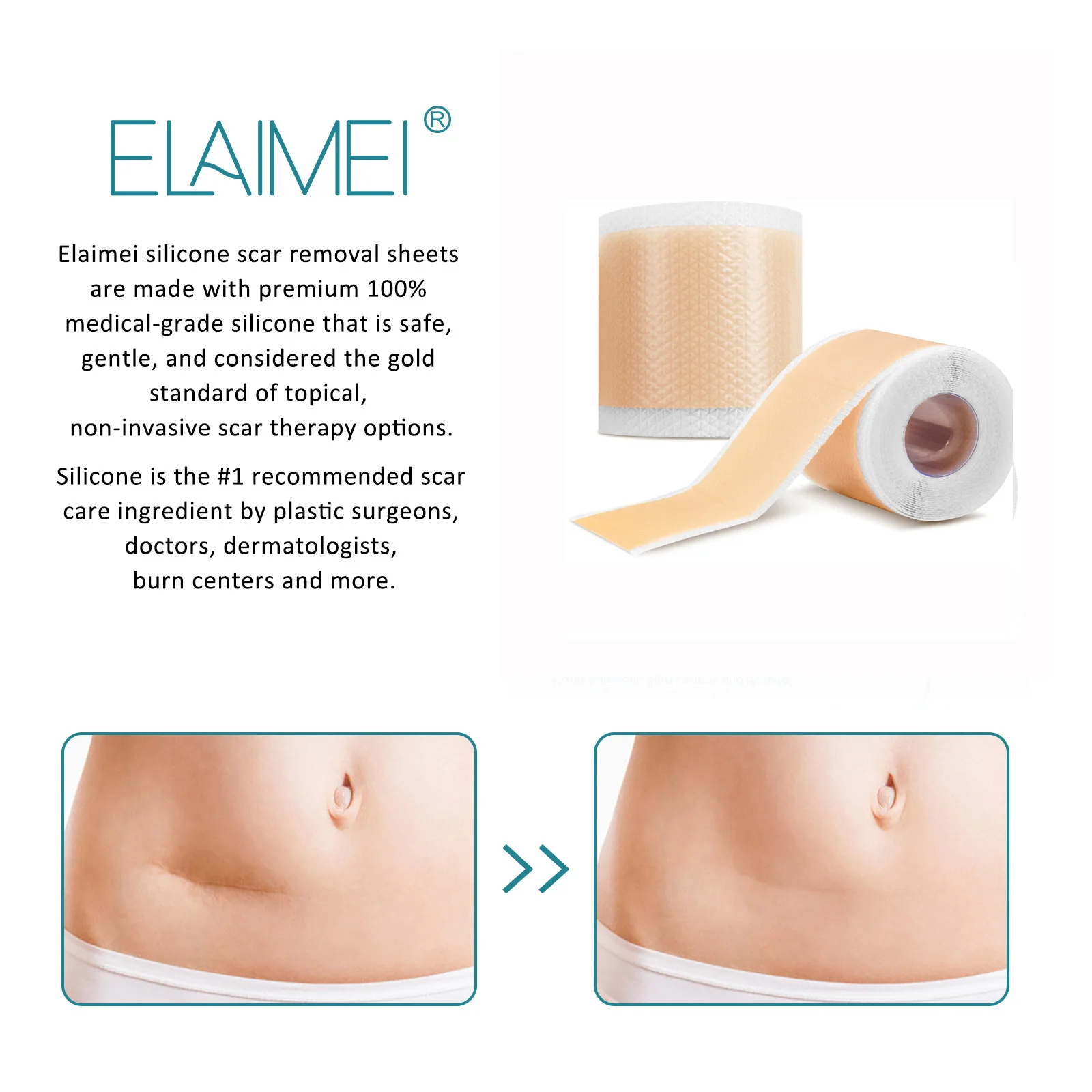 Силиконовые полоски для удаления шрамов от прыщей 300 см