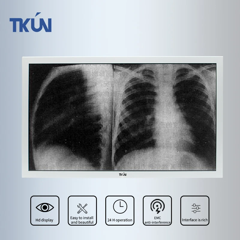 

TKUN 23.8/27 Inch High-definition Medical Display, Can be Customized,SDI Multiple Interfaces Monitor