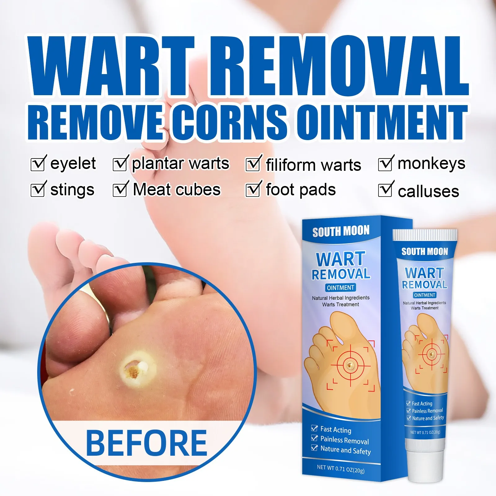 Painless Mole Skin Dark Spot Warts Remover Serum Freckle Fac