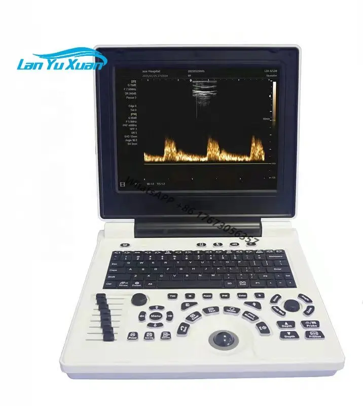 

Promozione del produttore E2 3D color doppler ultrasound machine price