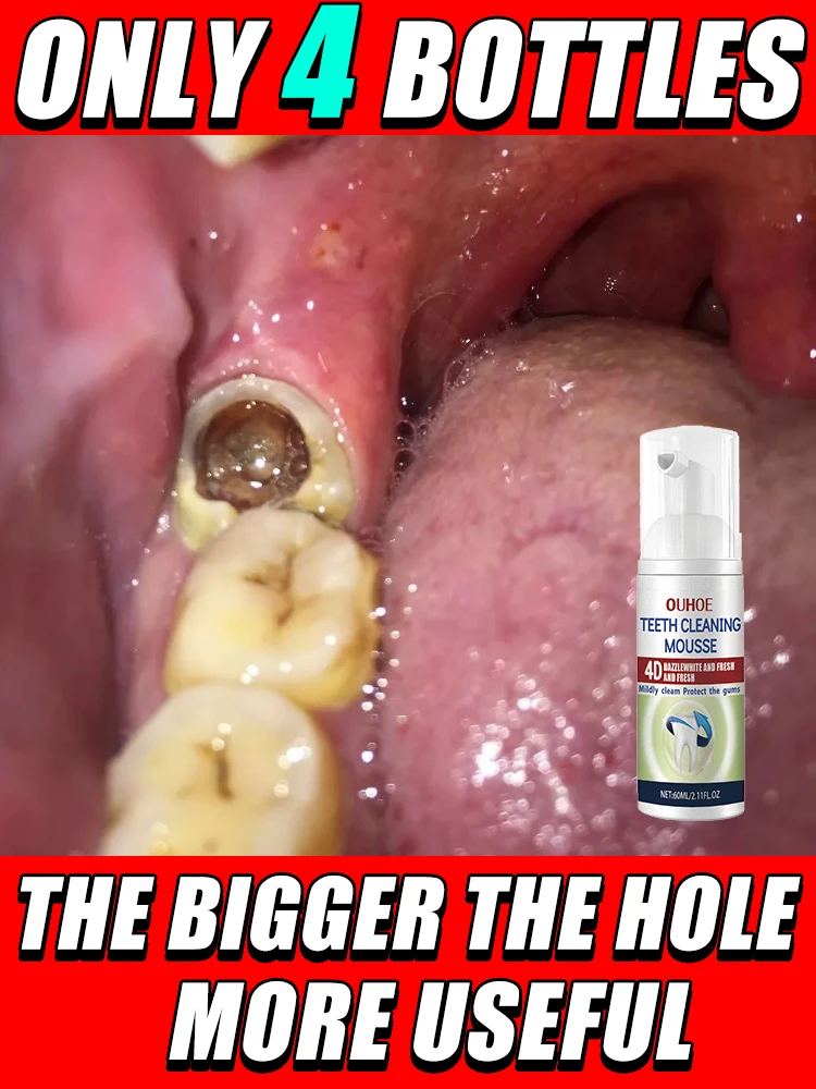 

Anti-cavity tooth decay fresh bad breath repair tooth decay remove plaque toothache relieve periodontitis