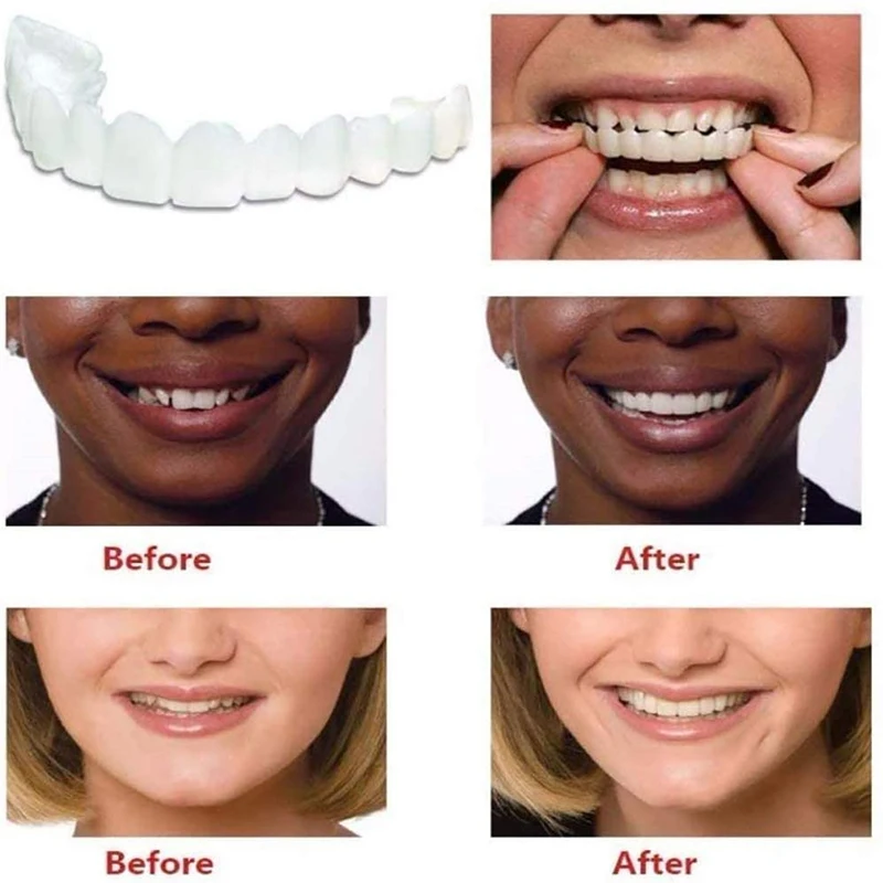 teeth whitening Teeth Braces Simulation Denture Dental veneers Silicone fake Perfect Smile braces False tooth 2Pcs/Set - купить по