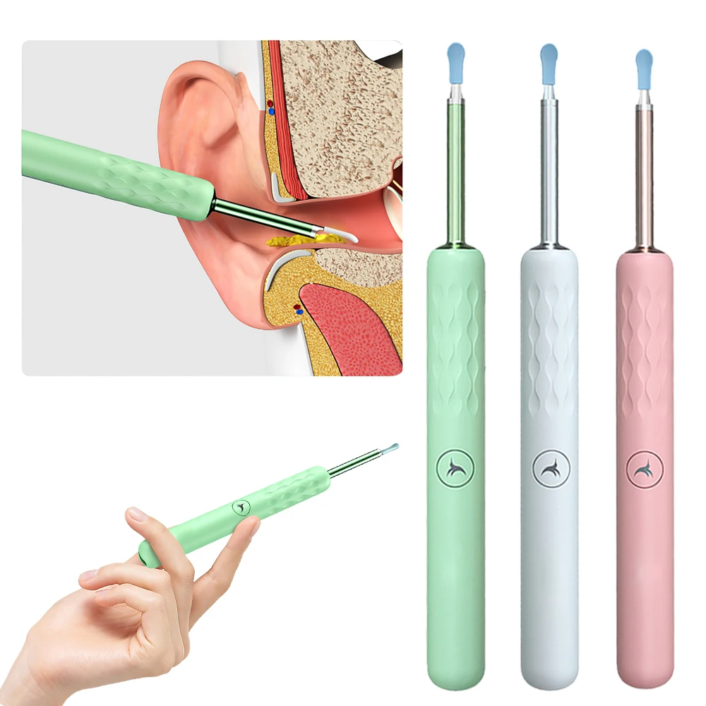 

Умный визуальный ушной карандаш, эндоскоп 300 Вт, высокоточный ушной карандаш, отоскоп, уход за здоровьем, ушной очиститель, умный визуальный ...