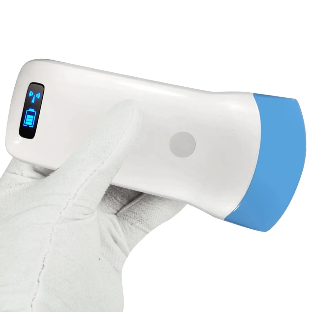 80/128 элементов 3 5/5 0 МГц Wi-Fi беспроводной ультразвуковой сканер выпуклая матрица