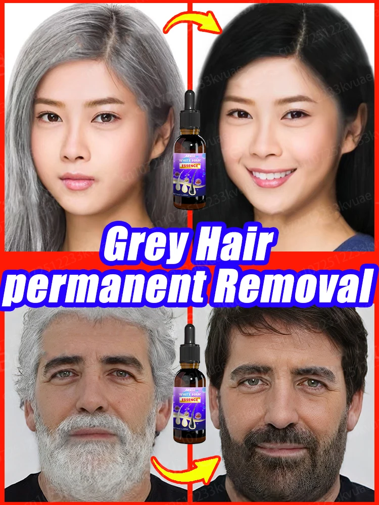 

Gray Hair Treatment Serum White to Black Natural Color Repair Nourishing Products Anti-Hair Loss Care Men Women