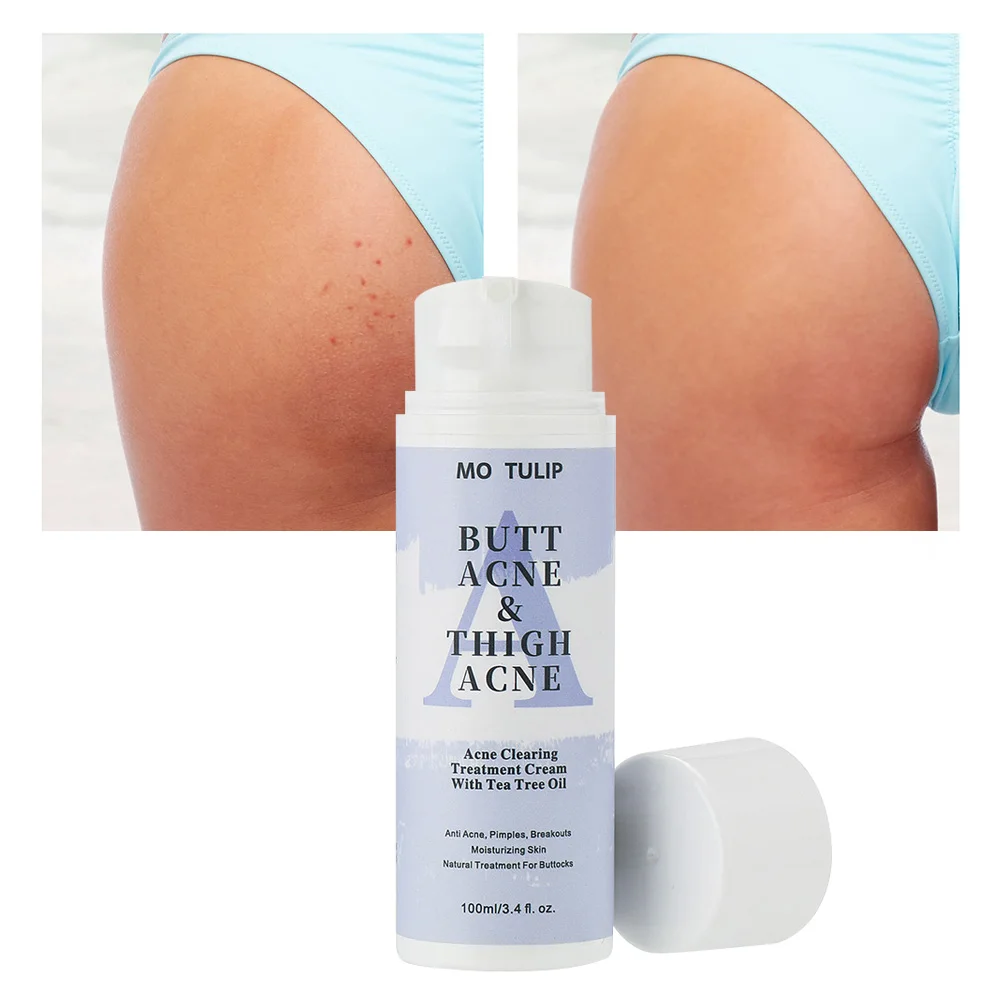 

Butt Acne Clearing Spot Treatment Cream Clears Acne Pimples Zits Razor Bumps and Dark Spot for the Buttocks and Thigh Area 100ml