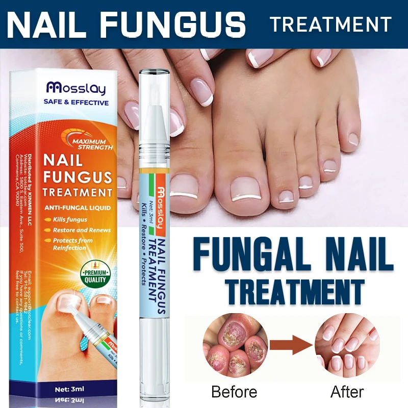 

Mosslay Nail Fungus Treatment Essence Serum Hand Foot Care Fungal Removal Repair Gel Anti-infective Paronychia Onychomycosis