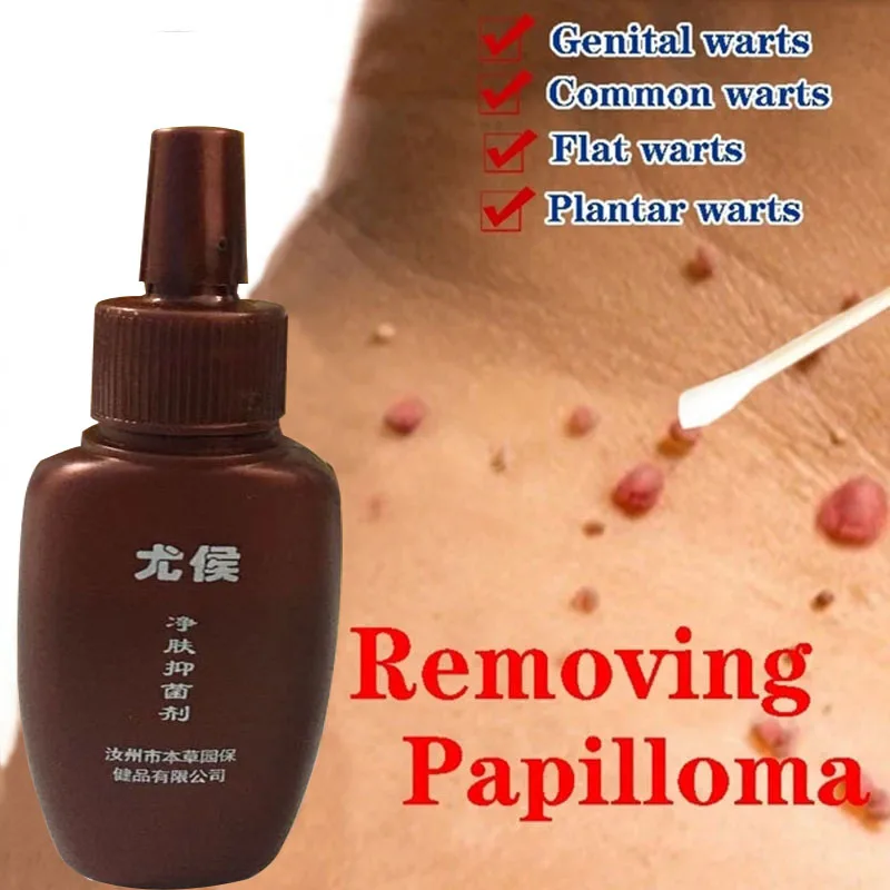 

Skin Tag Remover Genital Wart Treatment Instant Removal Mole&Papillomas Foot Corn Repair Tool Natural Bacteriostatic Liquid