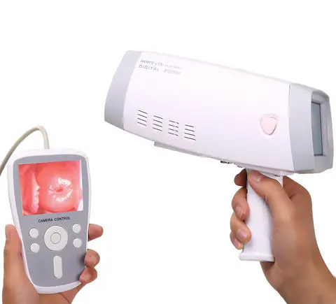 

The handheld portable Video Colposcope for women health