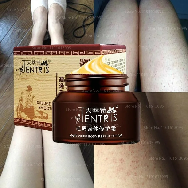 50g /ml Curing Keratosis Pilaris Kp Chicken Skin Repair Cream Body Lotion Skin Skin Care Essence Moisturizing and Nourishing
50g /ml Curing Keratosis Pilaris Kp Chicken Skin Repair Cream Body Lotion Skin Skin Care Essence Moisturizing and Nourishing