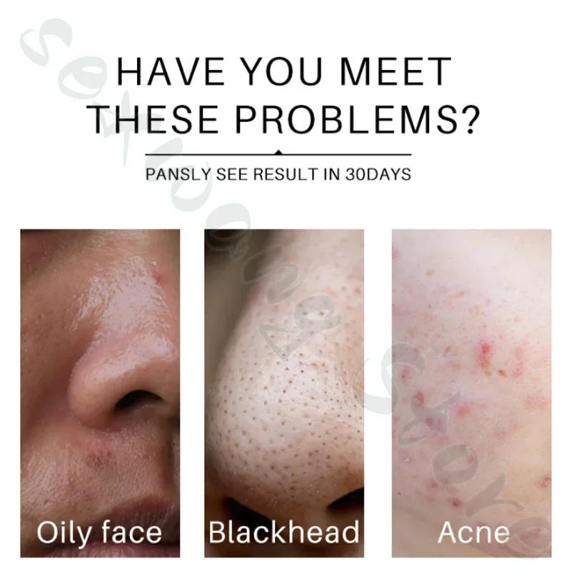 Anua Peach 70% ниацинамид сыворотка Houttuynia эссенция тонер чистое восстановление кожи