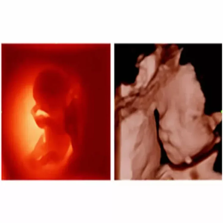 Медицинское ультразвуковое устройство Mindray портативный цветной допплер